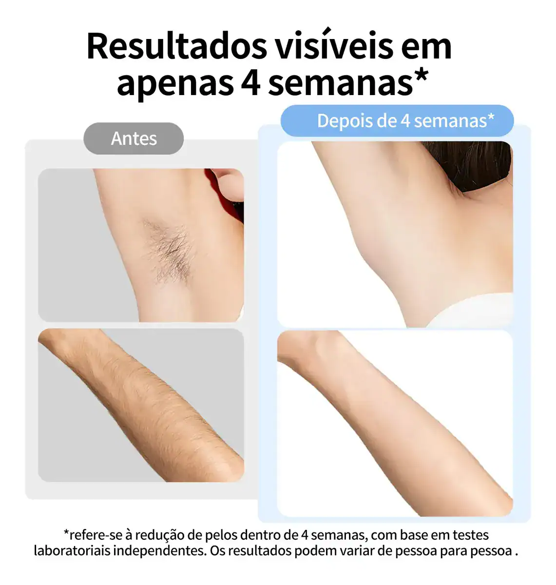 Depilador a Laser IPL Ulike ME Portátil Sem Dor com Resfriamento em Safira 4 Modos Disparo Automático Corpo e Rosto ANVISA - Imagem 2