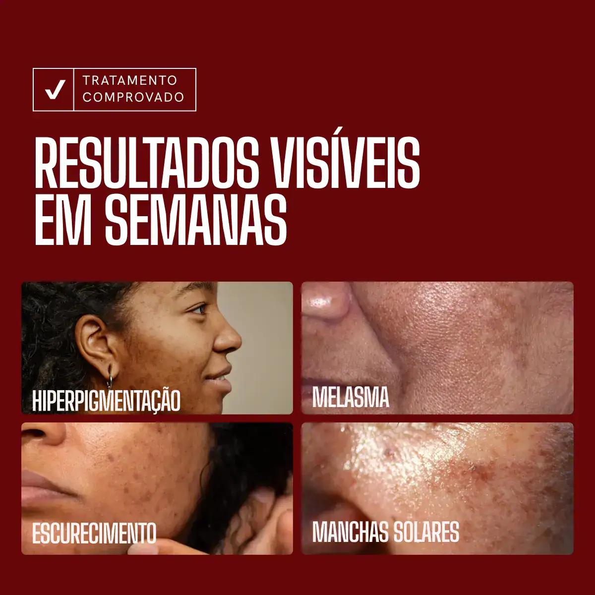 Sérum Zencial Envy Skin Ácido Tranexâmico Clareador Manchas e Melasma Profundo 30 mL - Imagem 4