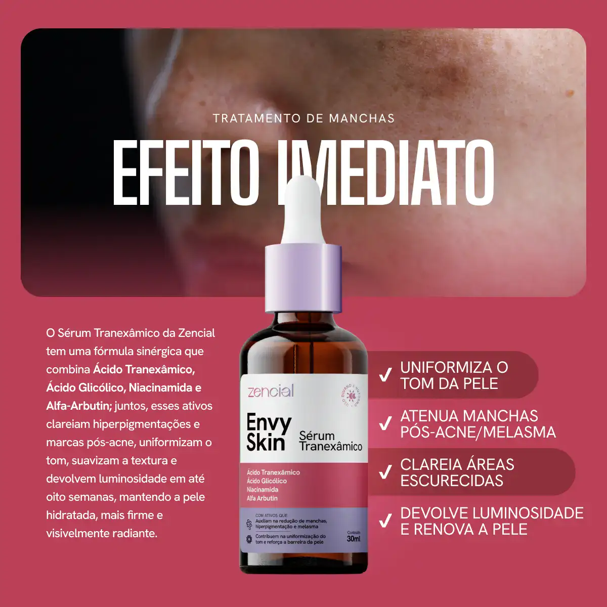 Sérum Zencial Envy Skin Ácido Tranexâmico Clareador Manchas e Melasma Profundo 30 mL - Imagem 5