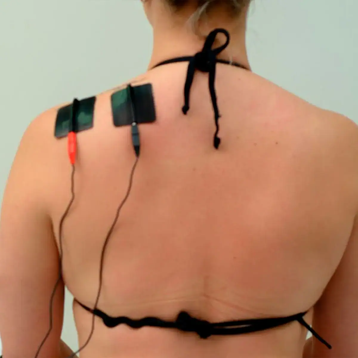 Neurodyn Ii Tens Fes E Corrente Russa Fisioterapia Ibramed - Imagem 3